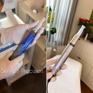 Mehr über den Artikel erfahren Glowneedling vs SkinPen: