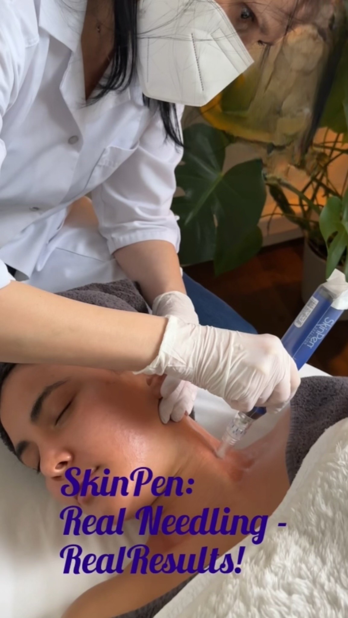 SkinPen