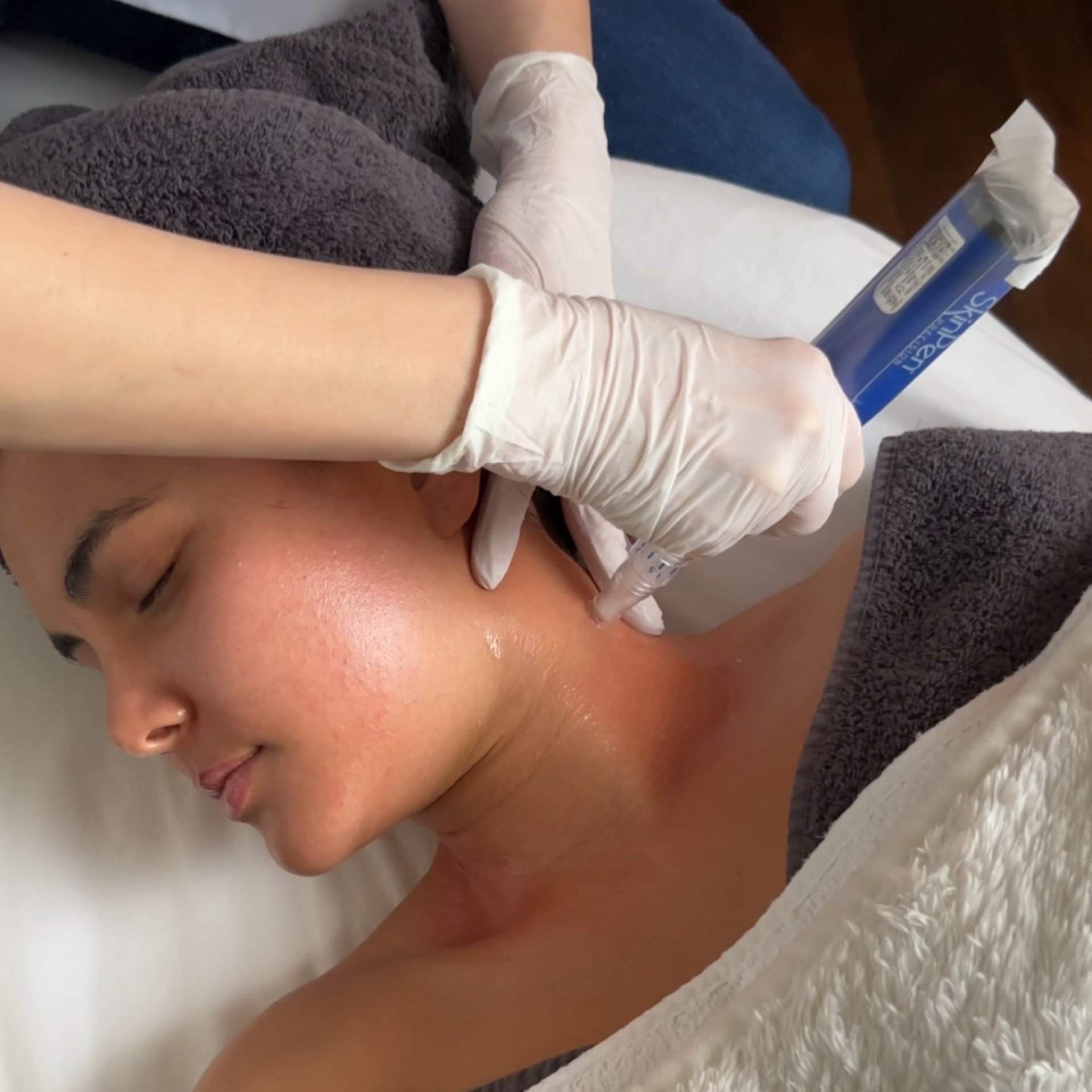 SkinPen