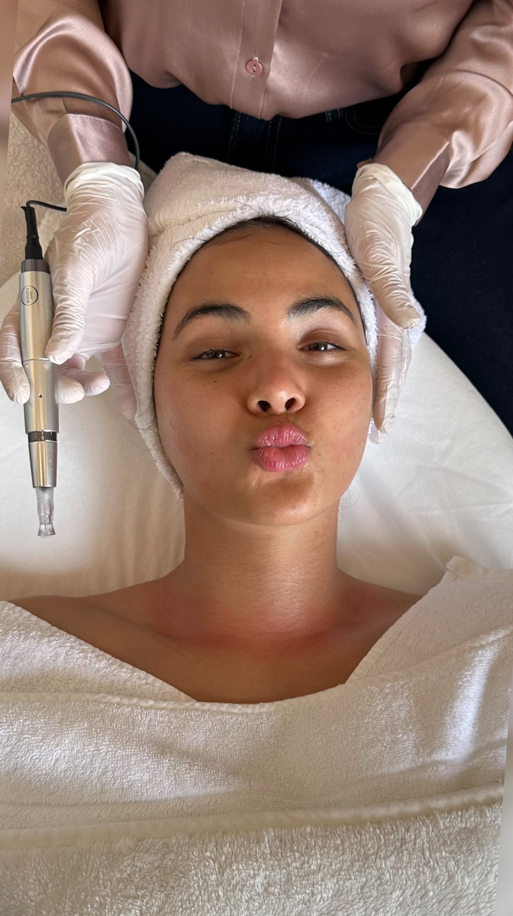 Read more about the article MICRONEEDLING MIT HERZ!